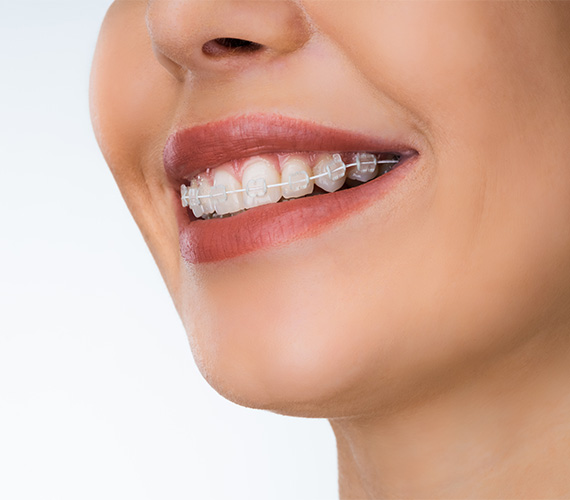 矯正歯科・小児矯正歯科